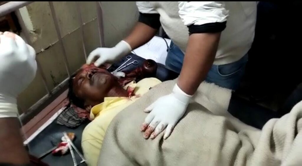 BJP Leader injured